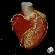 心臓3D画像